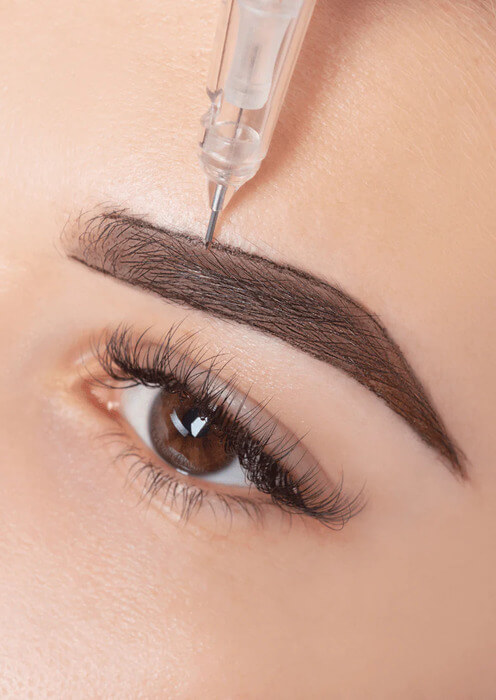 Restructuration d'un sourcil